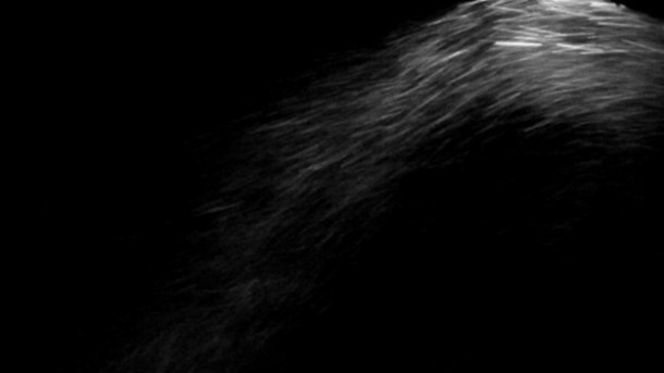 GFriedman-SnowStudy-II-stilla